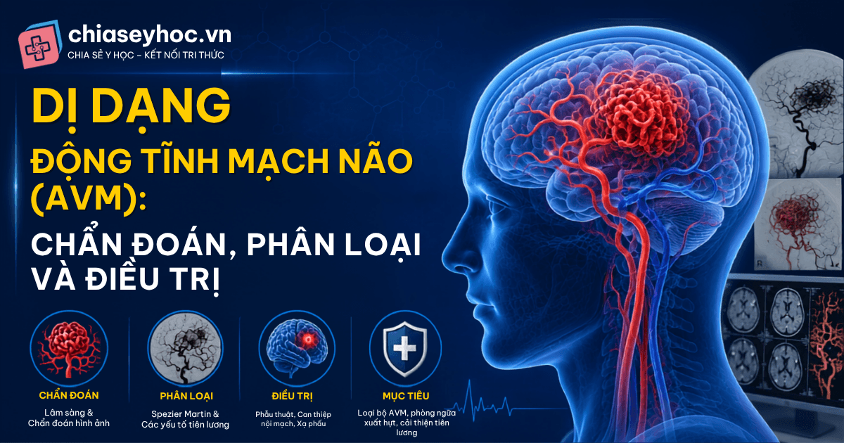 Dị Dạng Động Tĩnh Mạch Não (AVM): Chẩn Đoán, Phân Loại và Điều Trị