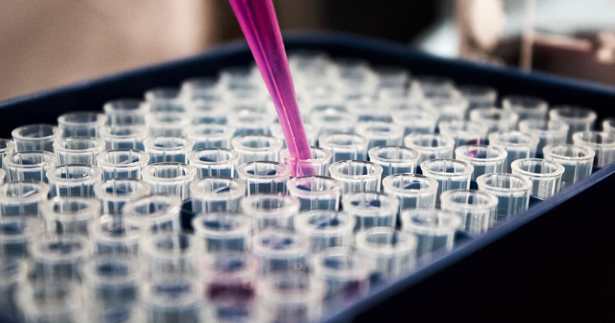 Tế bào gốc trong điều trị bệnh Parkinson: Hy vọng mới từ phòng thí nghiệm