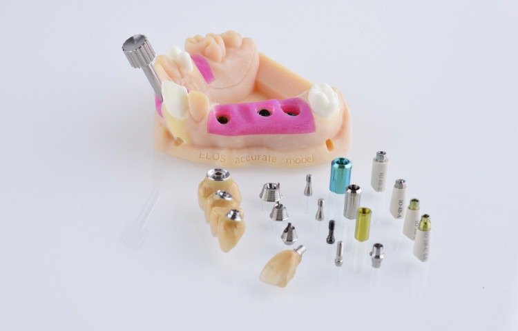 3D printed dental models and implants